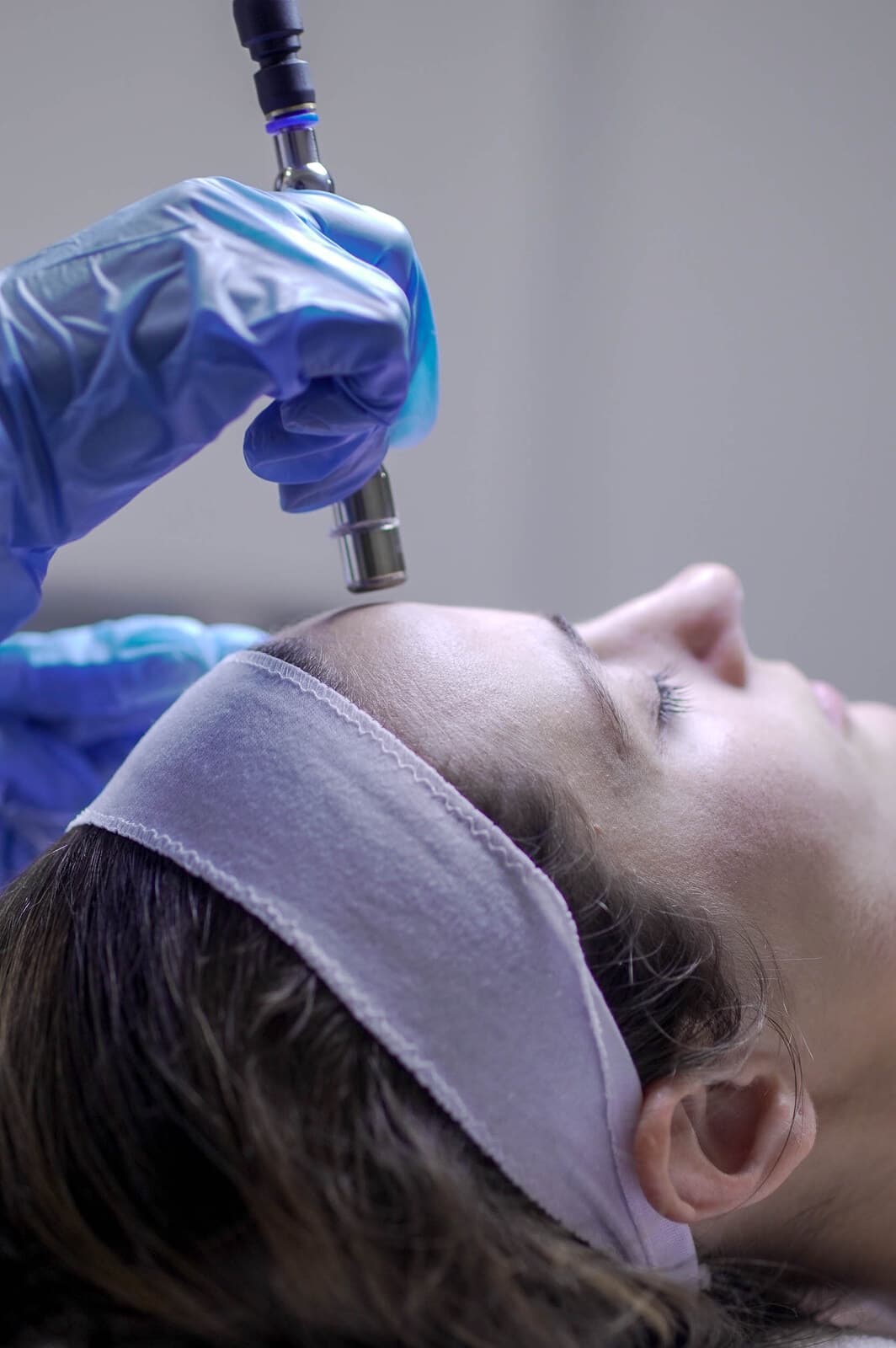 Microdermabrasion Facial