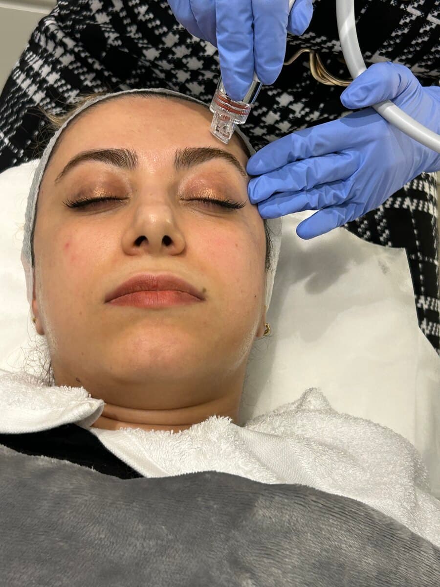 HydraFacial
